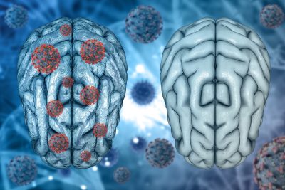 Desvendando os Subtipos do TDAH: Como um Exame Cerebral Revela Diferenças Cruciais 4 Uma ilustração que mostre o cérebro humano com o núcleo lenticular em destaque, representando a importância dessa região cerebral para o TDAH. A imagem deve transmitir a ideia de que o estudo focou em uma área específica do cérebro e que essa região pode ser crucial para o transtorno.