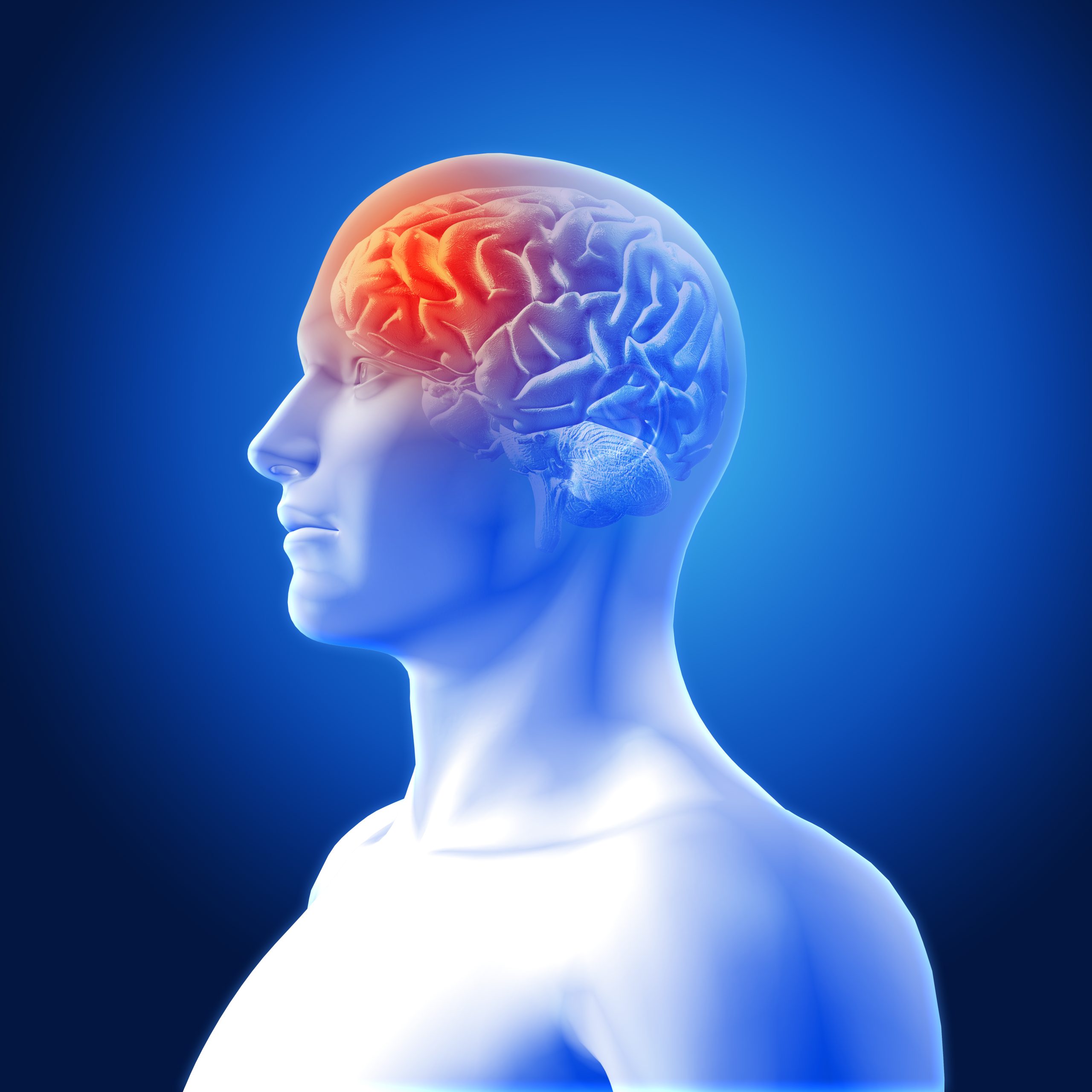 A Influência da Rede de Modo Padrão na Criatividade e na Imaginação 3 headache representation scaled