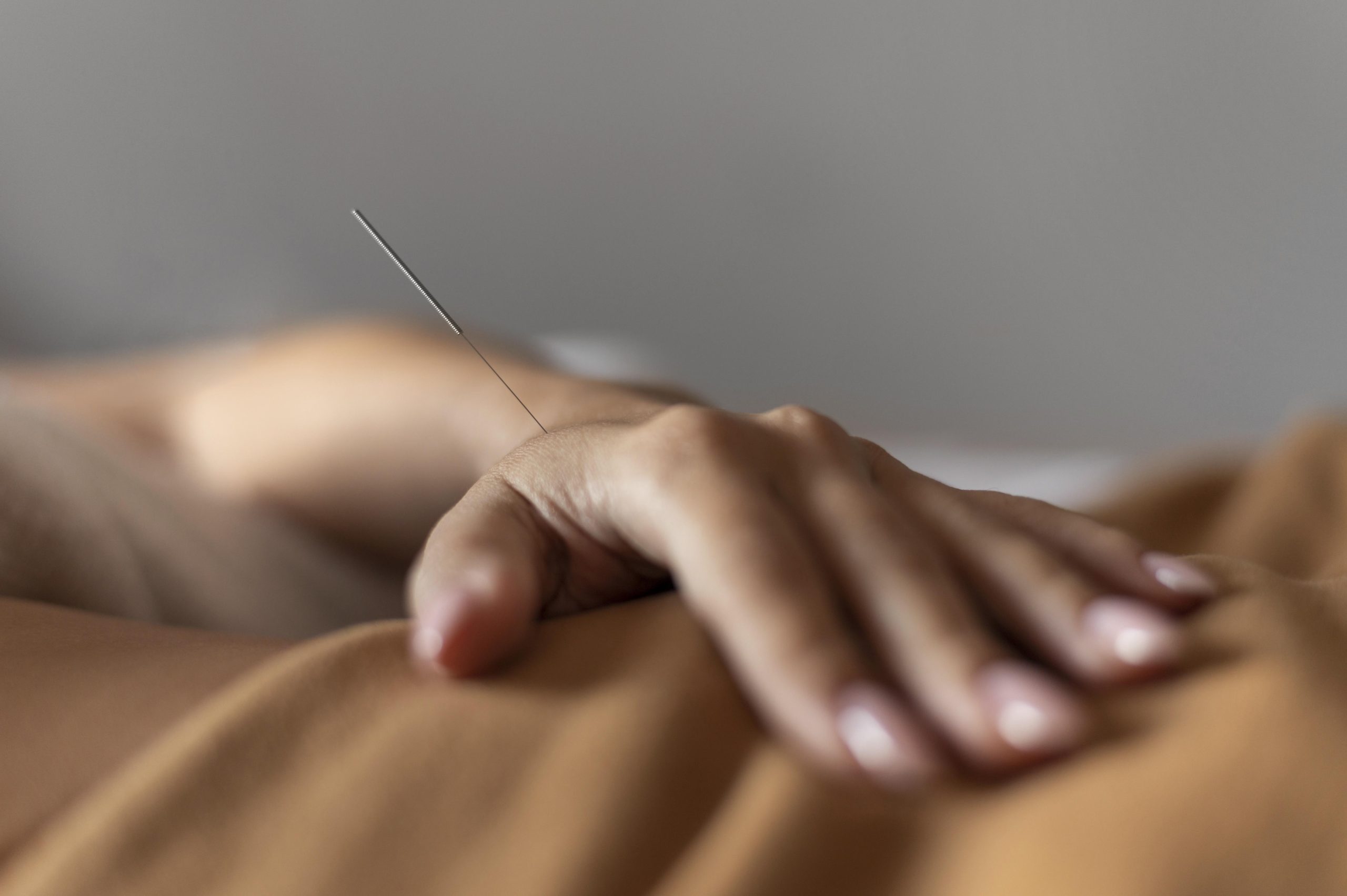 Regulação Emocional no TDAH: Descubra o Poder do EFT 4 close up hand with acupuncture needle scaled